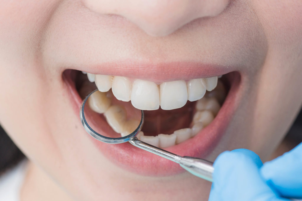 Wisdom Teeth Removal for Teens in Dallas | Children's Dental & Ortho