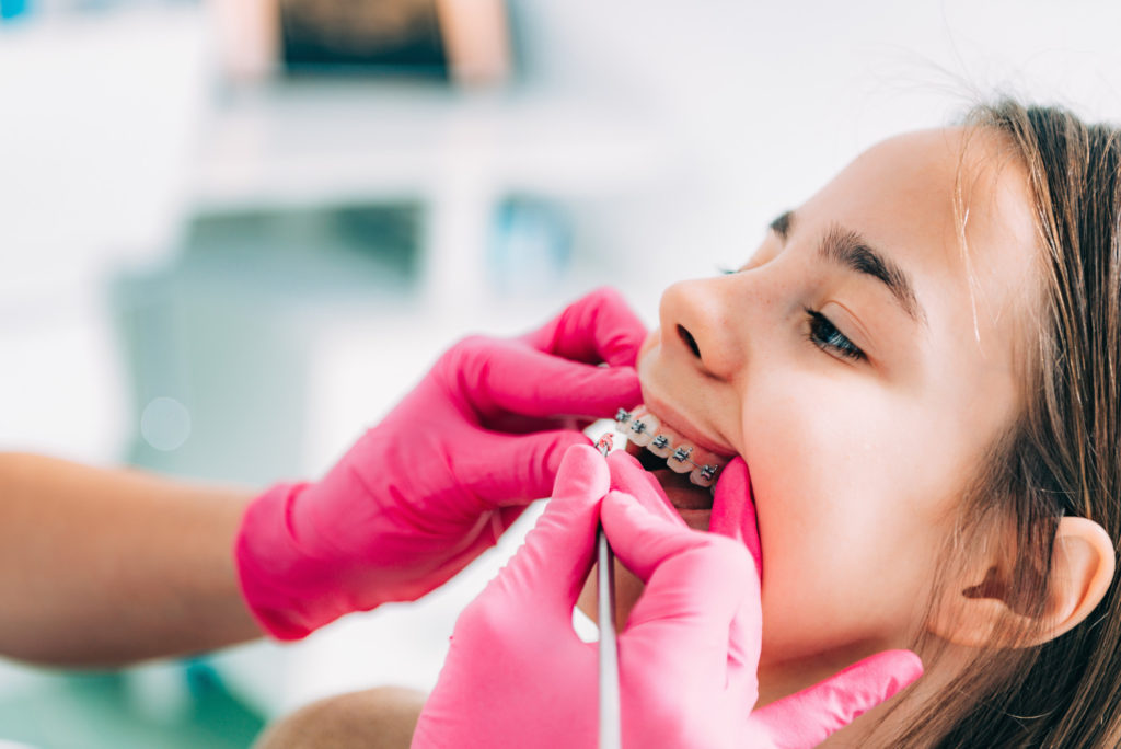 Top Questions to Ask Before Choosing a Dallas Orthodontist
