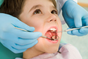 signs your child has a cavity